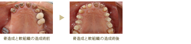 軟組織
