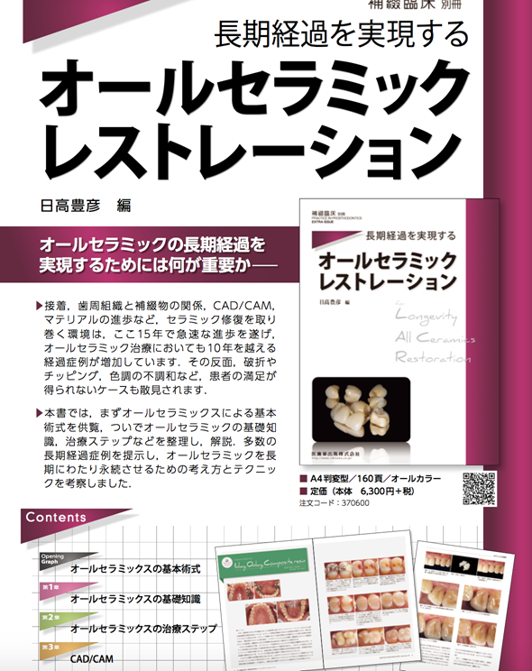 長期経過を実現するオールセラミックレストレーション